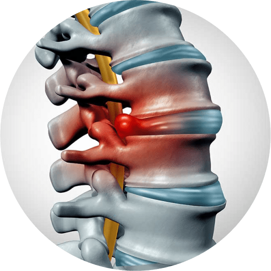 Spine Infection Treatment in Ahmedabad | Swasti Spine & Mind Care