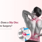 When Does a Slip Disc Require Surgery Red Flags You Must Not Ignore