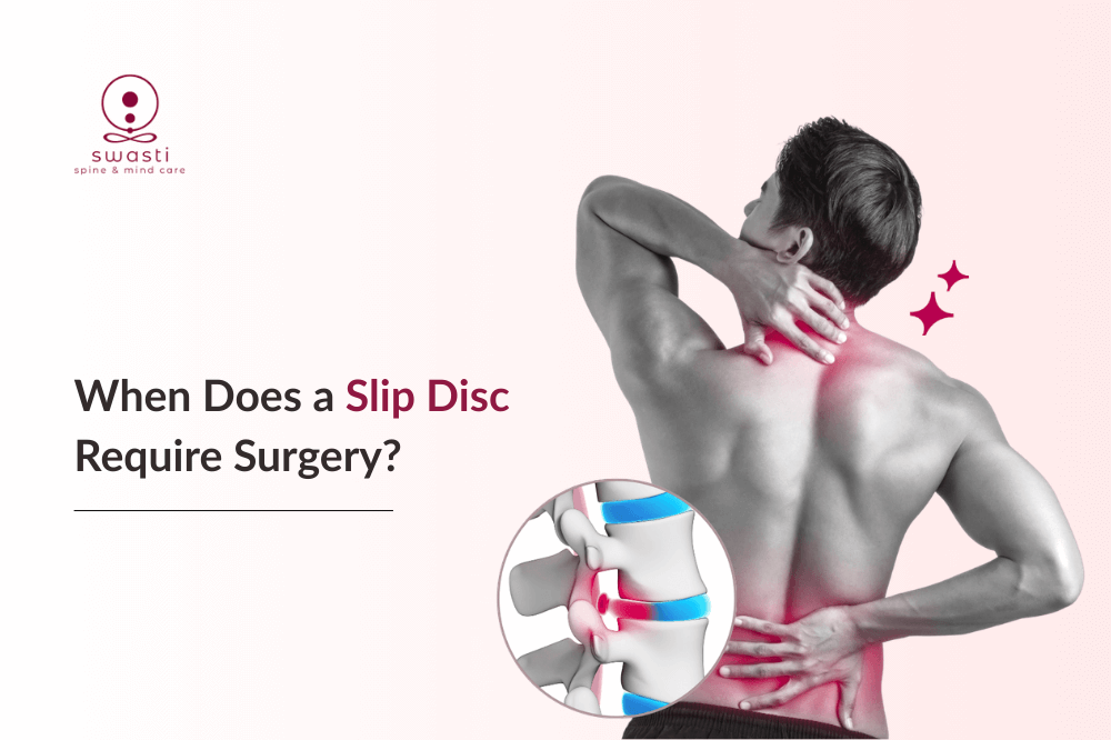 When Does a Slip Disc Require Surgery Red Flags You Must Not Ignore