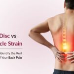 Slip Disc vs Muscle Strain