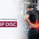 Can Gym Workouts Cause a Slip Disc?