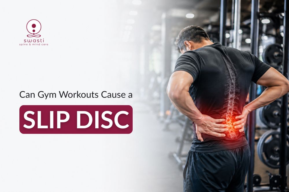 Can Gym Workouts Cause a Slip Disc?